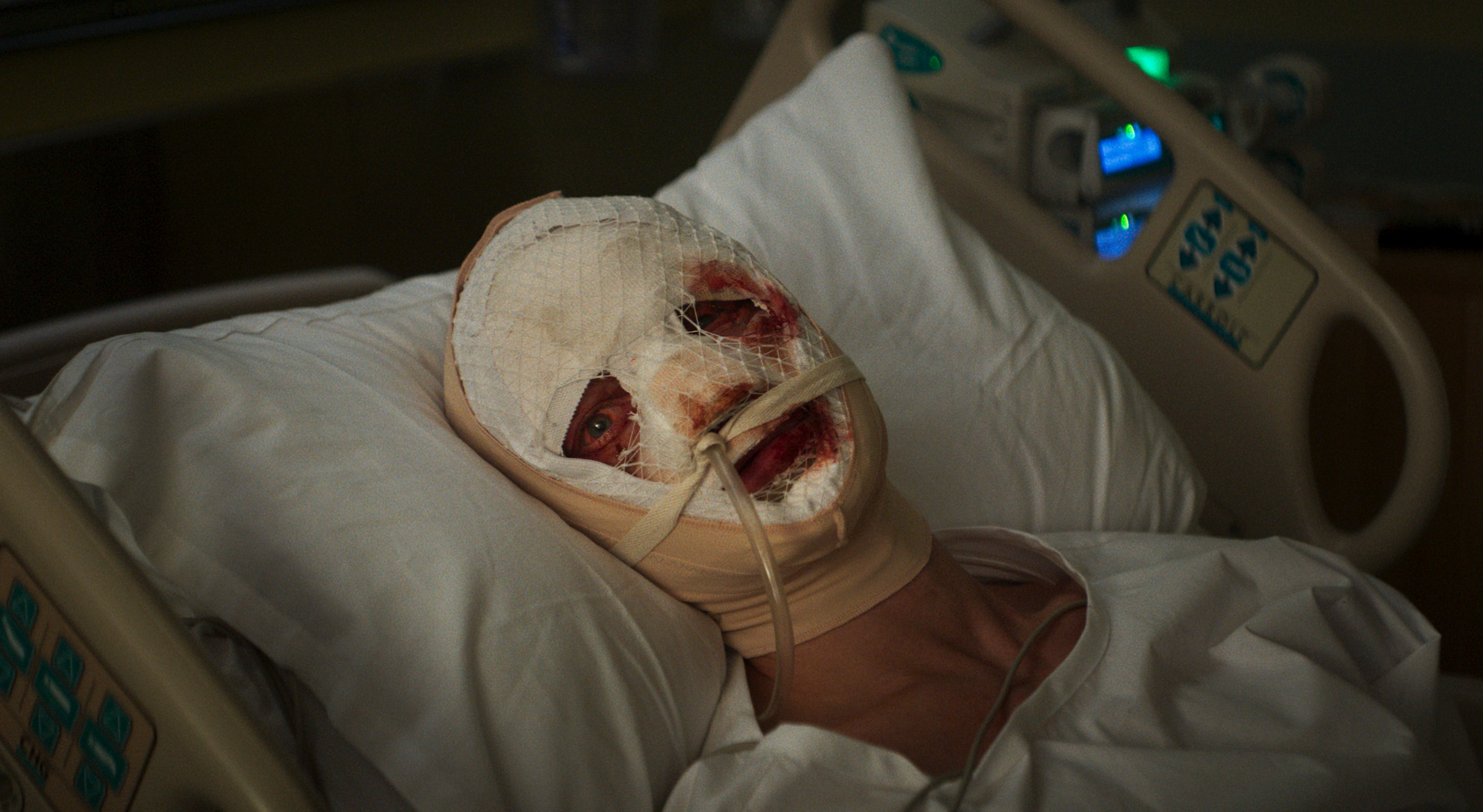 Matt Hagen vendado en una cama de hospital en Clayface
